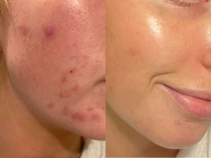 Skin Perfecting BHA Liquid Exfoliant Full size