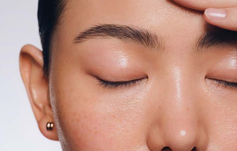 What are milia? Causes, treatments & prevention tips