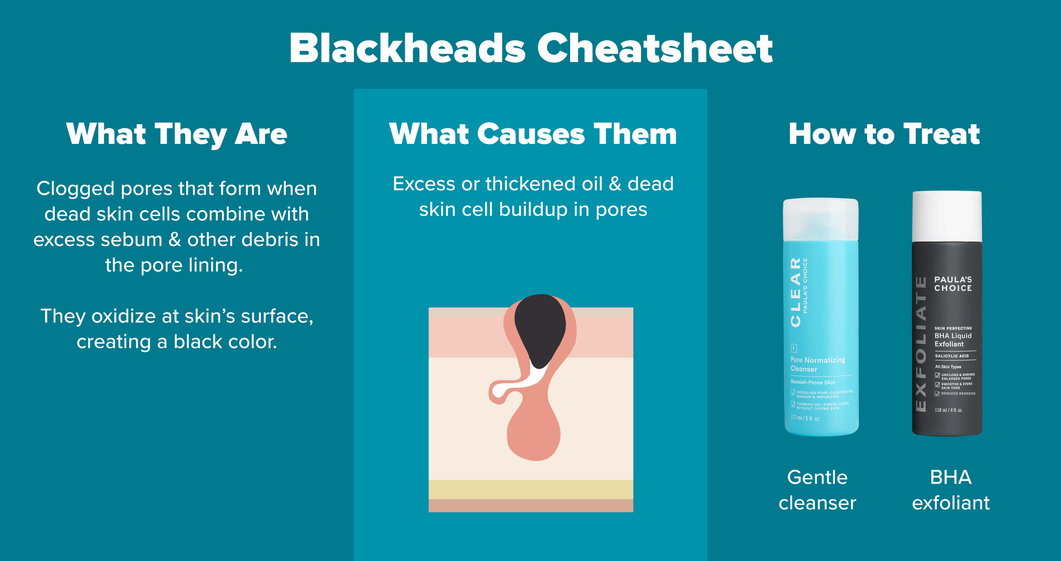 A closer look at Acne Treatment For Large Pores On Face