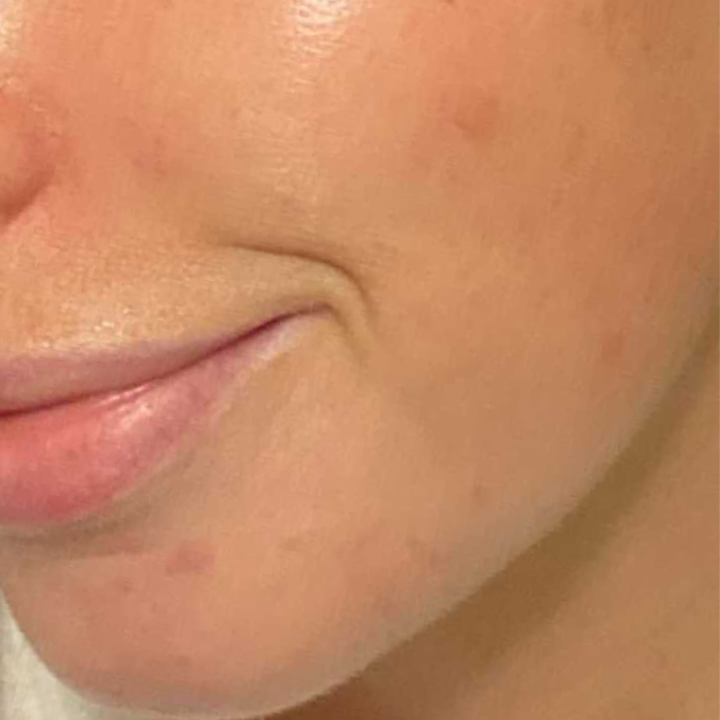 Na 4 weken of using BHA exfoliant