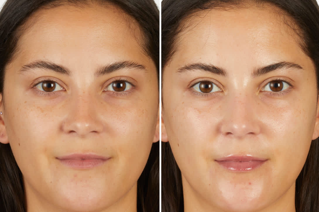 Before and after skin comparison