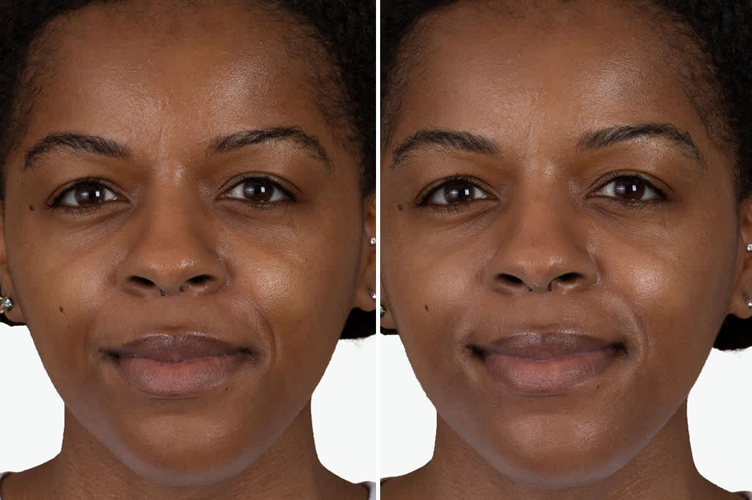 Before and after skin comparison