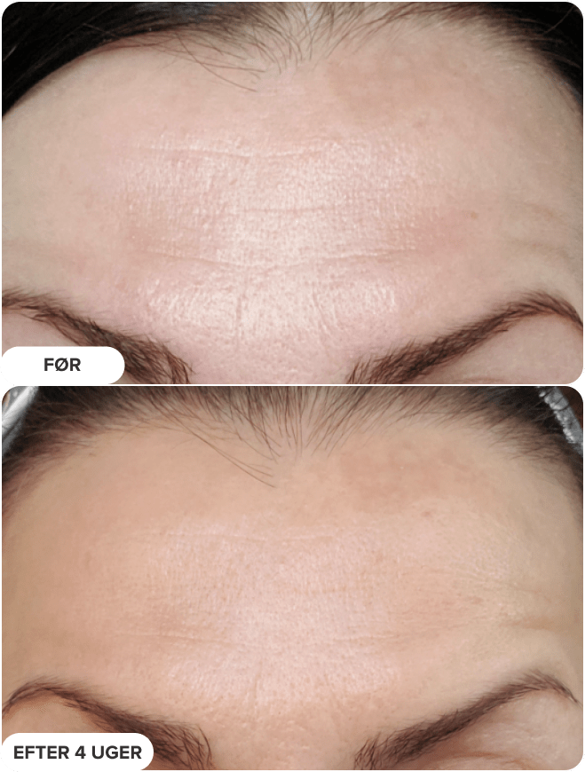 SKIN PERFECTING 2% BHA Eksfoliering