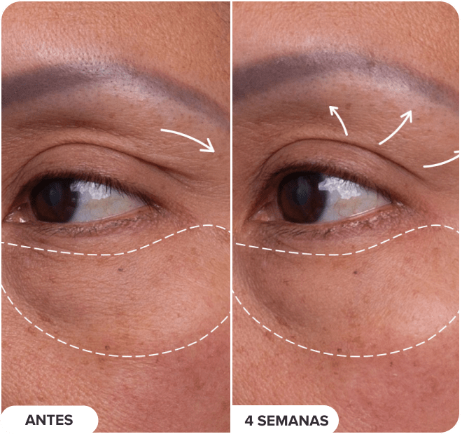 Pro-Collagen Peptide Firming Eye Serum