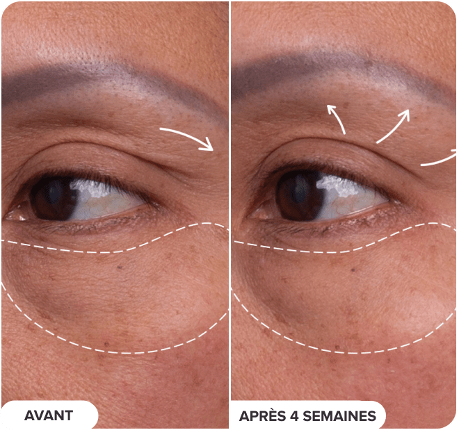 Pro-Collagen Peptide Firming Eye Serum