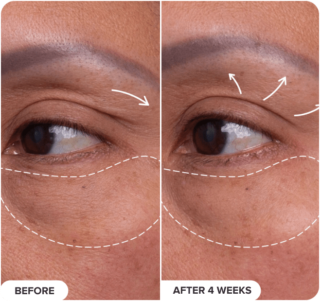 Pro-Collagen Peptide Firming Eye Serum