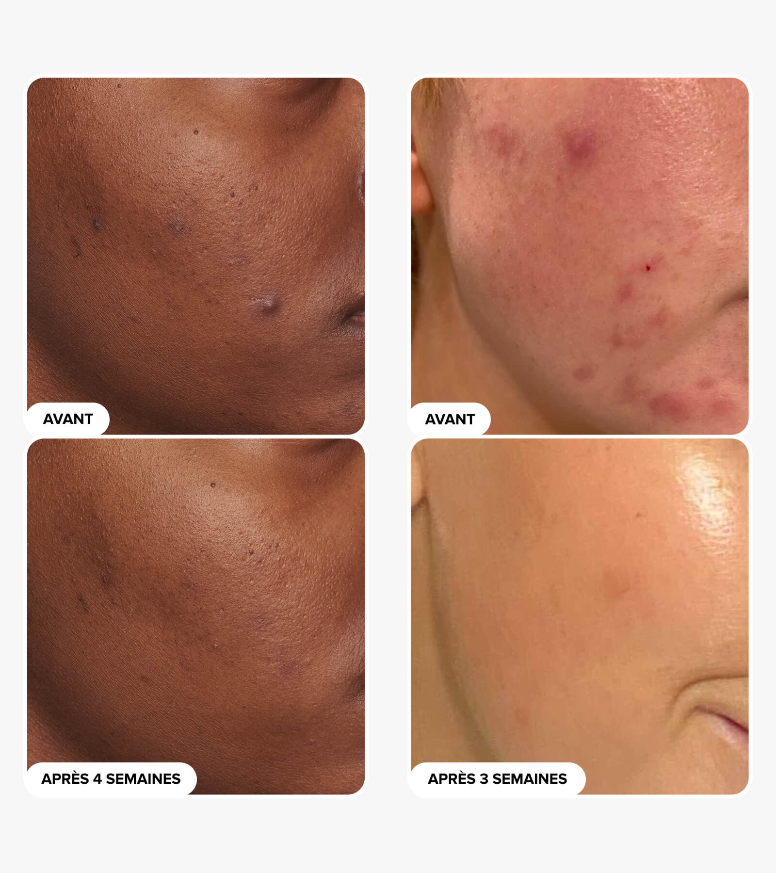 Lotion Exfoliante 2 % BHA SKIN PERFECTING