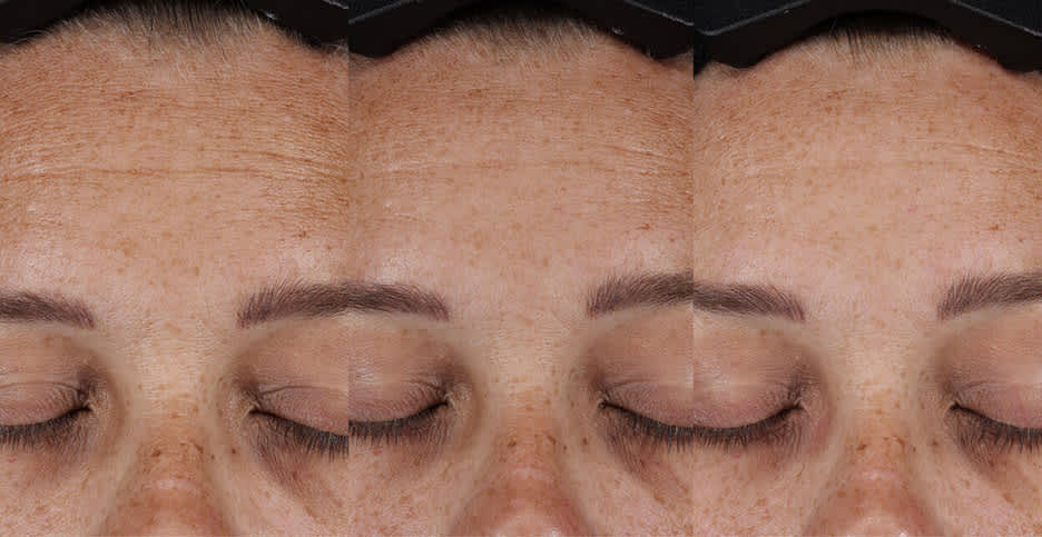 Pro Retinaldehyde Dual-Retinoid Treatment | Paula's Choice