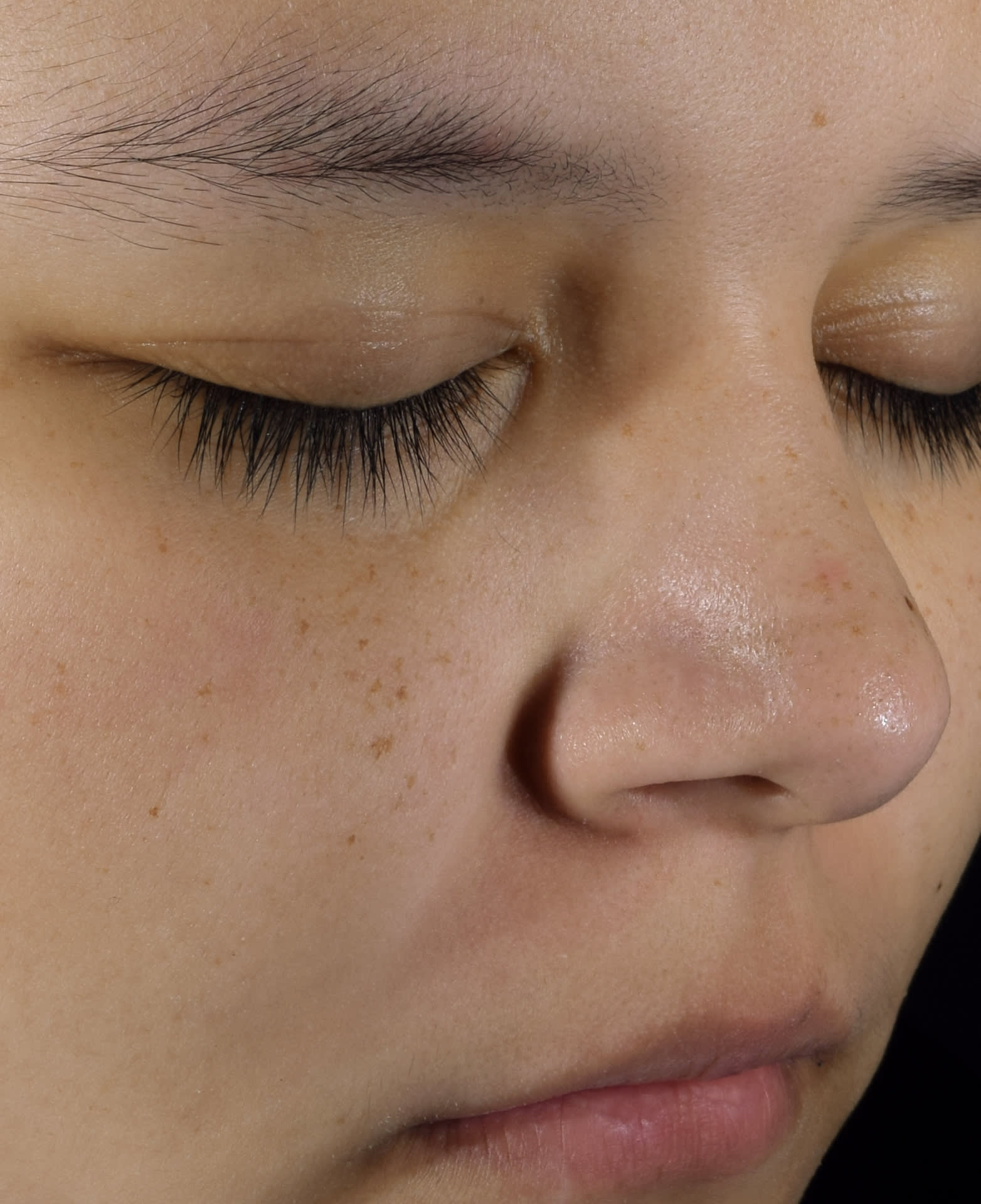 After improved skin barrier